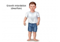 New drug for growth hormone deficiency in children! 