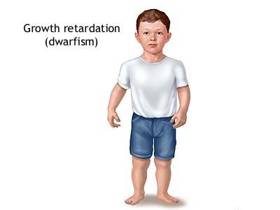 HGH